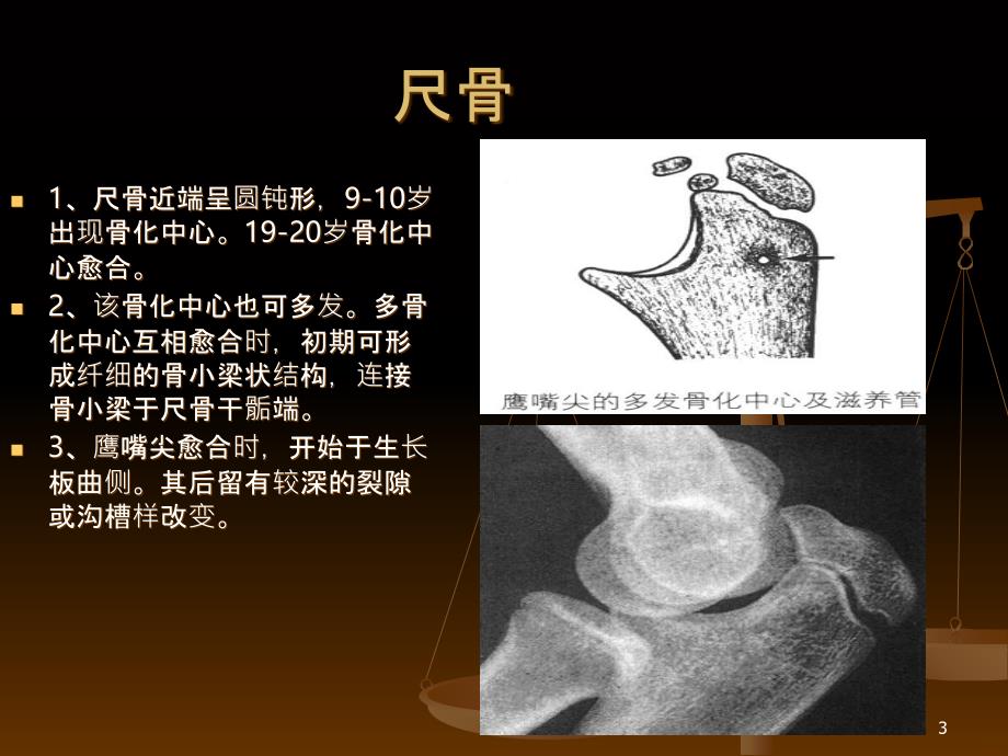 肘关节X线表现PPT课件_第3页