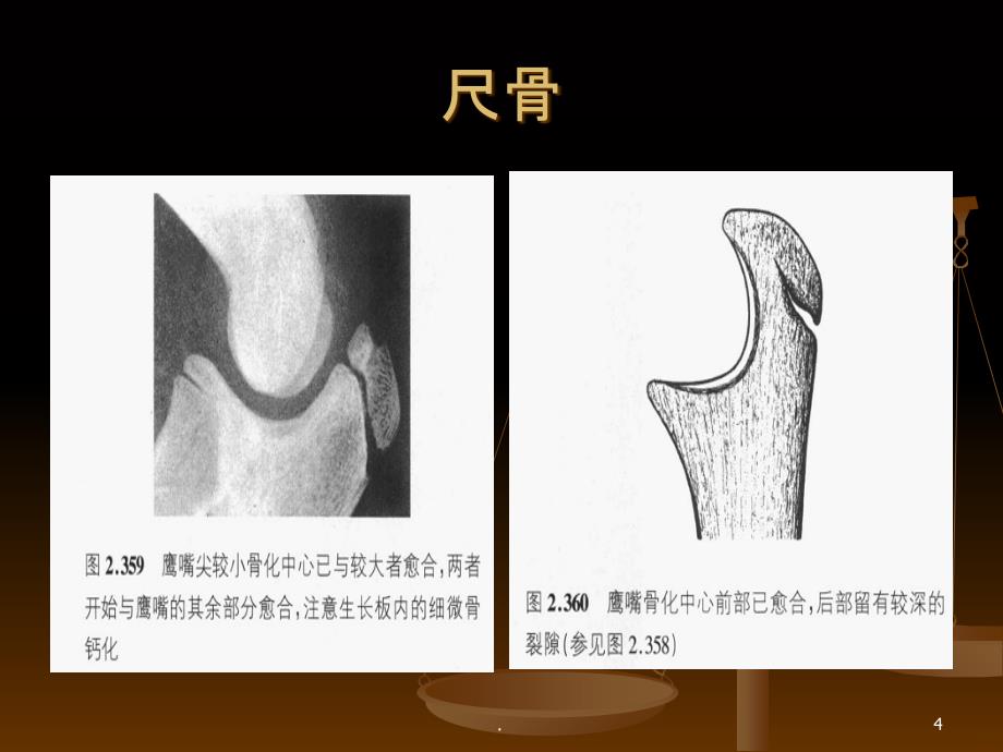 肘关节X线表现PPT课件_第4页