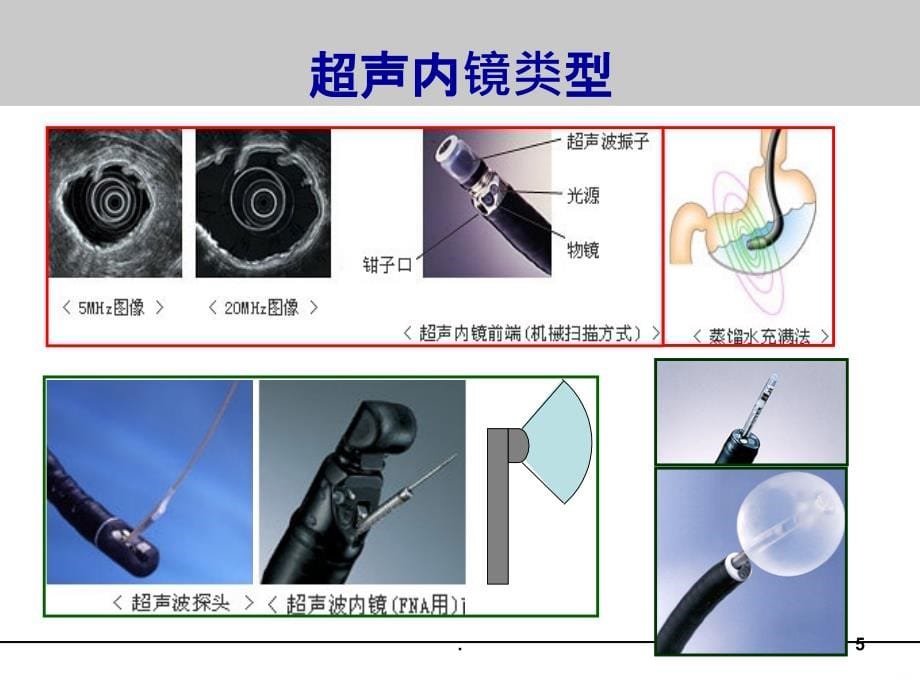 EUS在消化疾病中的应用PPT课件_第5页