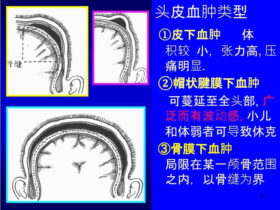 颅脑损伤病人的-护理PPT课件_第5页