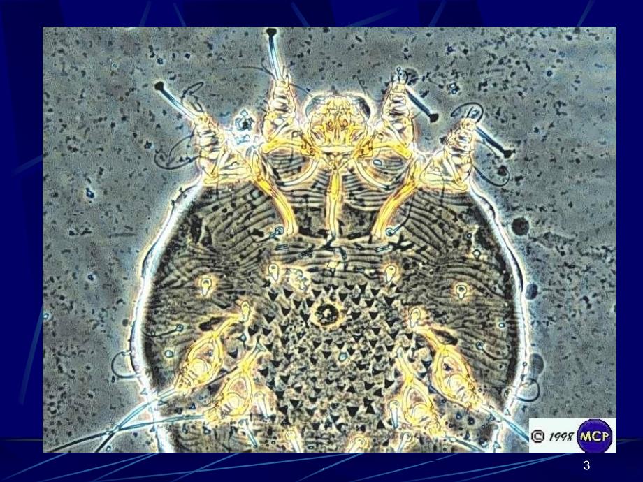 疥螨与疥疮PPT课件_第3页