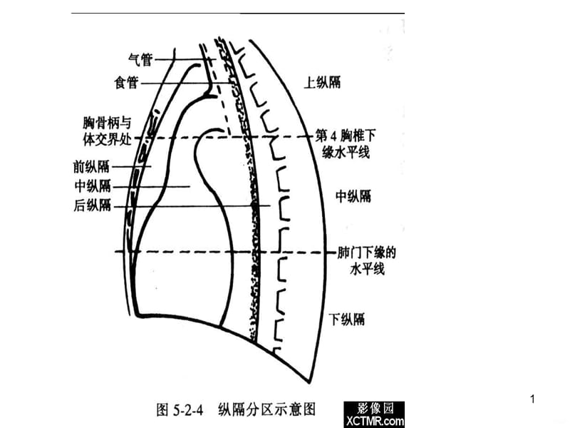 x线解剖PPT课件_第1页