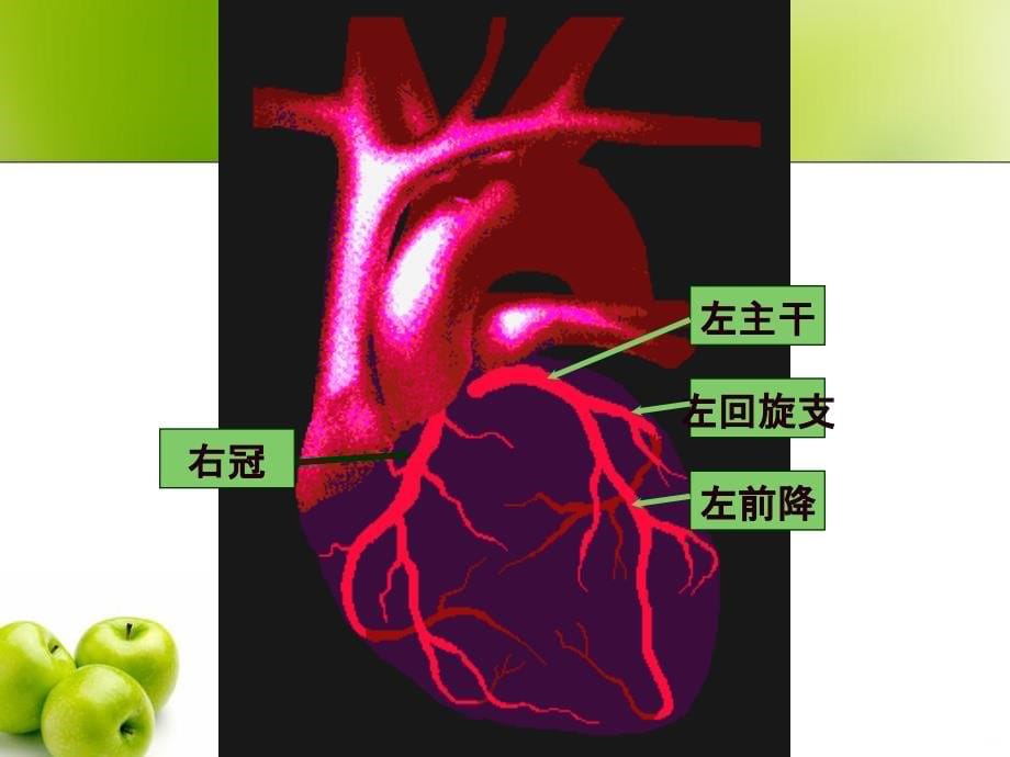 冠心病概论资料PPT课件_第5页