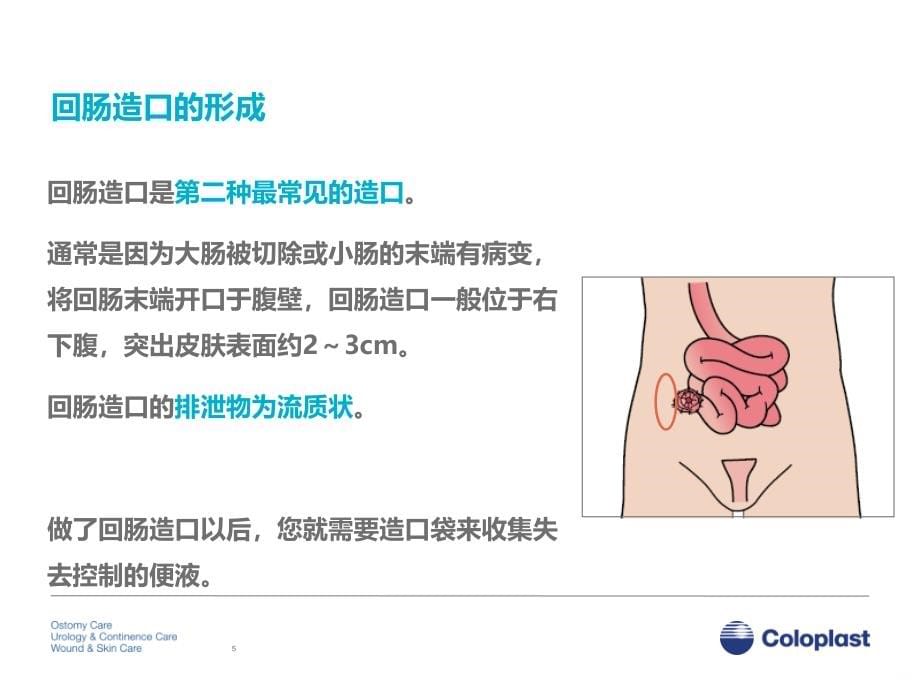 造口基础护理_和产品指导PPT课件_第5页