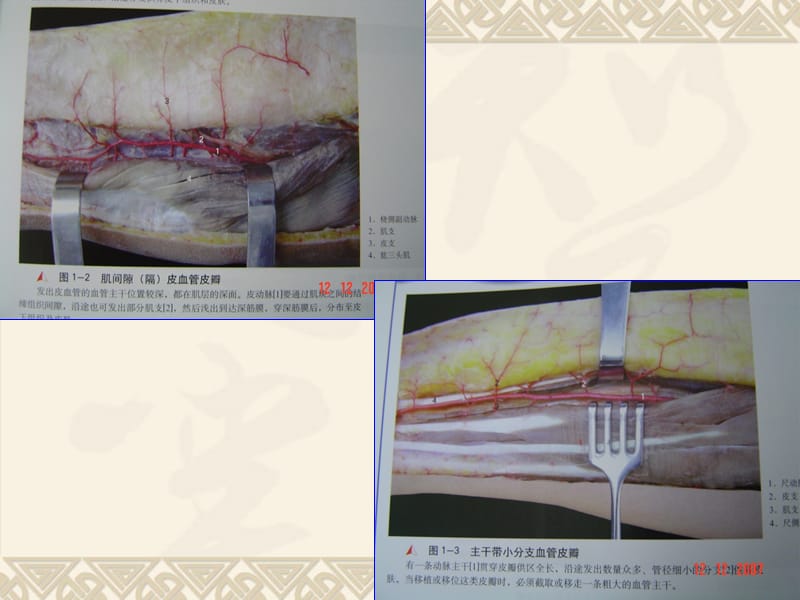 头颈主要皮瓣的解剖PPT课件_第5页
