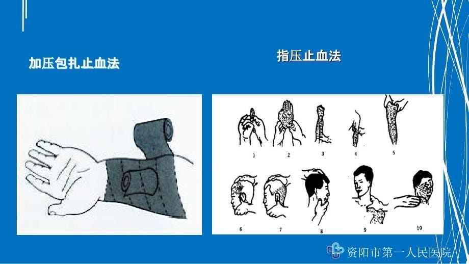 骨折急救基础知识讲座PPT课件_第5页