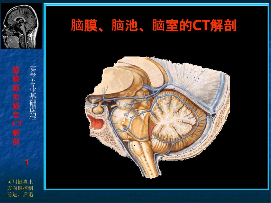 脑膜、脑池、脑室的CT解剖PPT课件_第1页