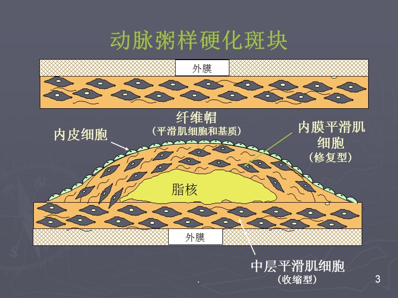 急_性_冠_状_动_脉_综_合PPT课件_第3页