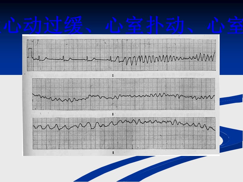 临床执业医师技能考试心电图及影像考试题答案_第4页