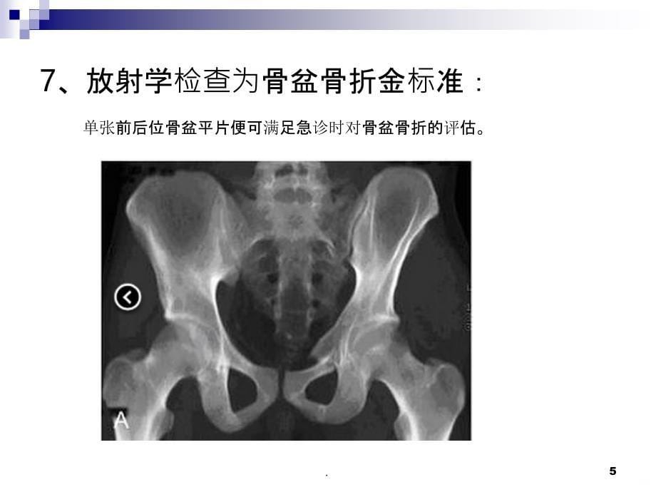 骨盆X检查拍摄要求PPT课件_第5页