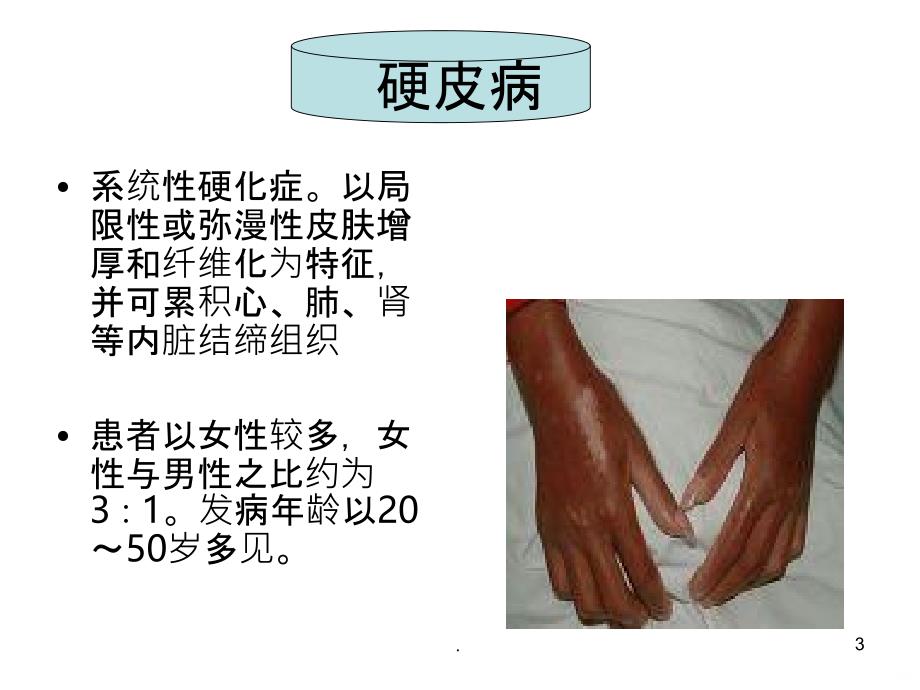 袪风湿药PPT课件_第3页