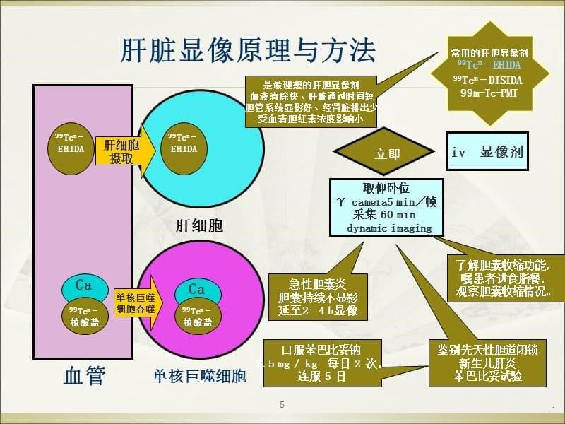 肝胆显像PPT课件_第5页