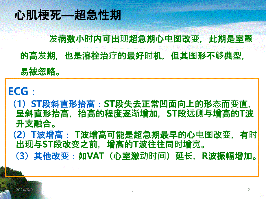 心肌梗死VS束支传导阻滞PPT课件_第2页