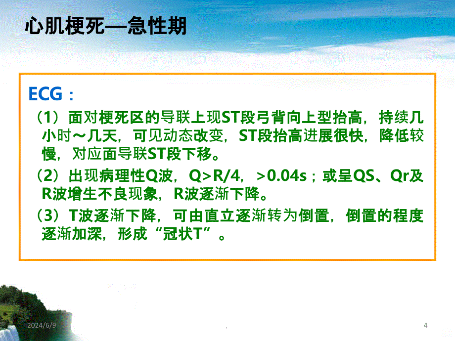 心肌梗死VS束支传导阻滞PPT课件_第4页