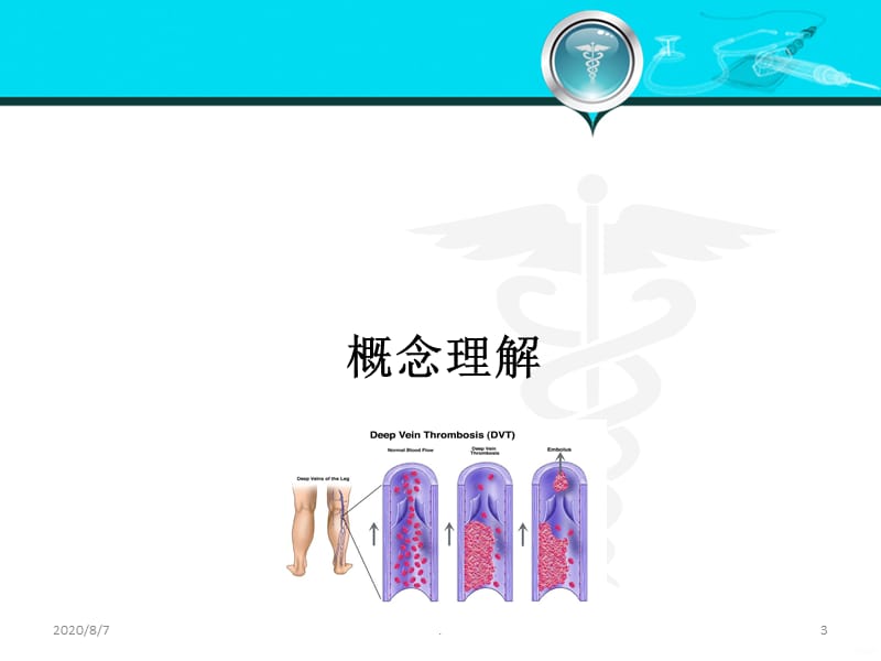 VTE的预防和治疗PPT课件_第3页