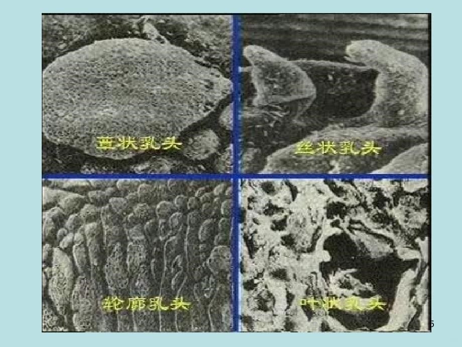 舌诊舌象PPT课件_第5页