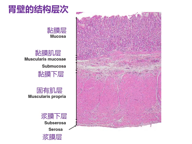 胃镜早癌ppt....pps_第2页