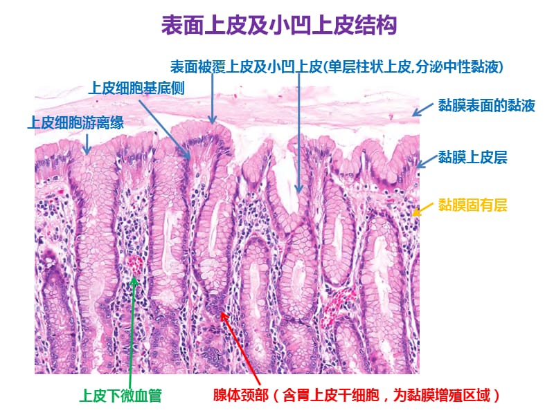 胃镜早癌ppt....pps_第3页