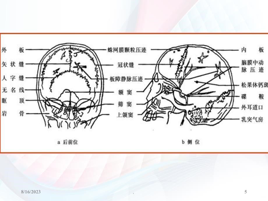 医学影像-中枢神经系统影像诊断学PPT课件_第5页