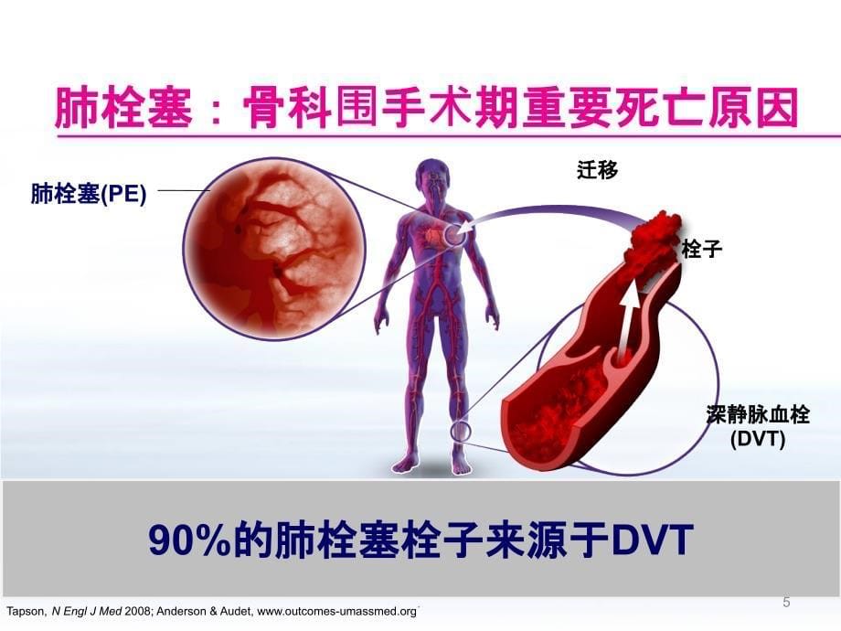 创伤骨科患者的VTE预防PPT课件_第5页