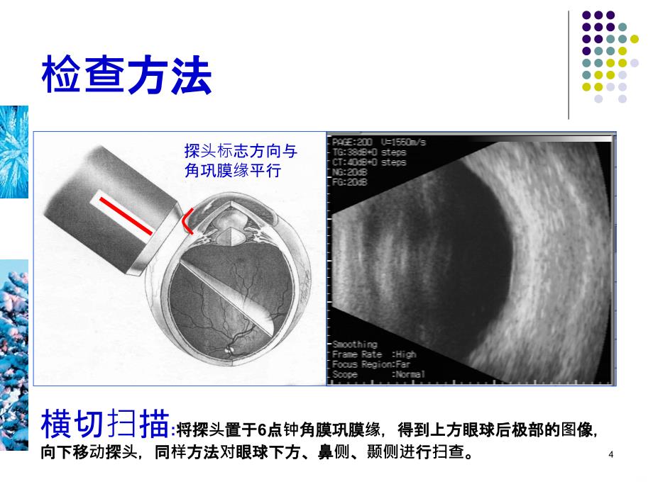 眼部疾病的超声诊断PPT课件_第4页