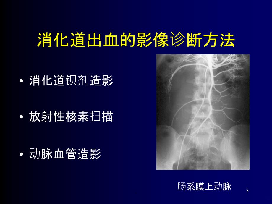 消化道出血-介入治疗精品PPT课件_第3页