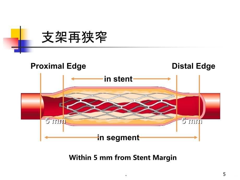 心血管神经官能症PPT课件_第5页