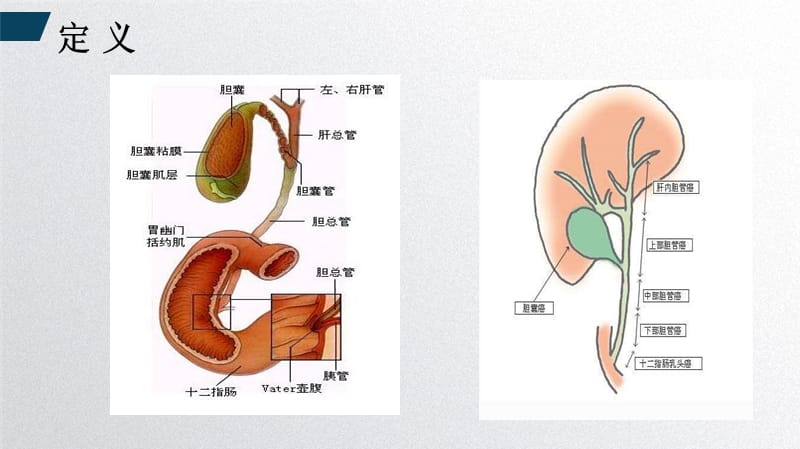 胆道肿瘤精品PPT课件_第3页