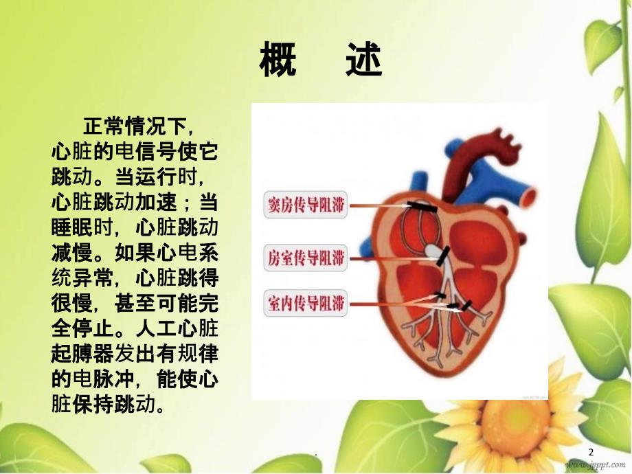 心脏永久起搏器植入术的护理PPT课件_第2页