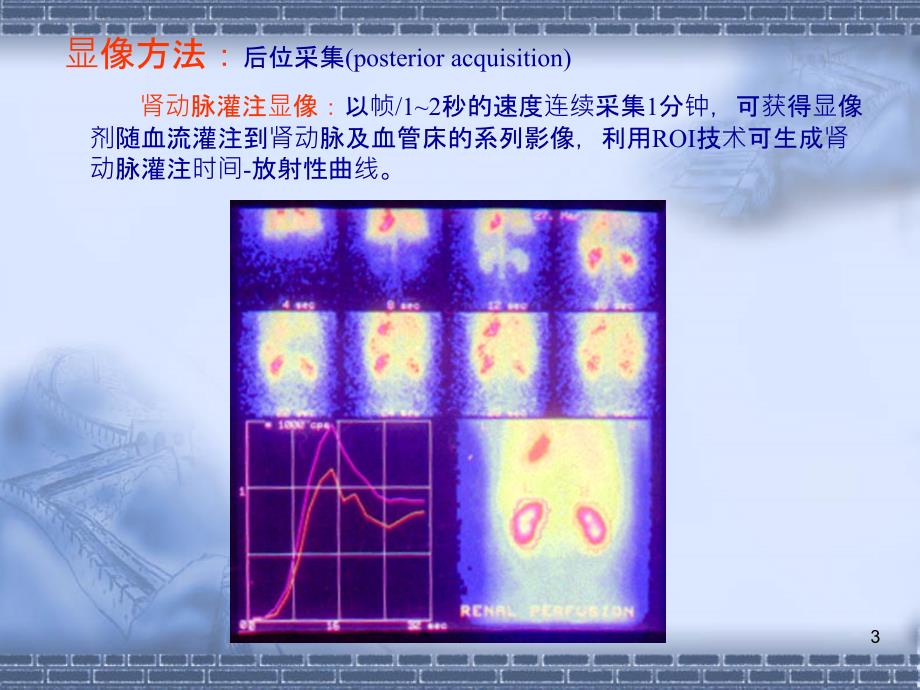 核医学：泌尿系统PPT课件_第3页