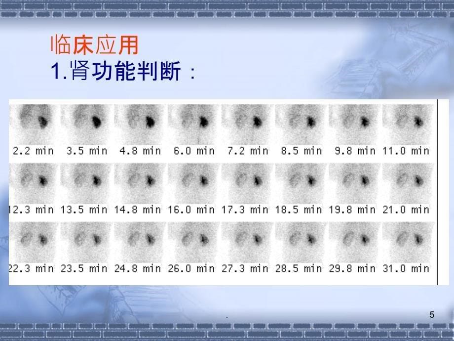 核医学：泌尿系统PPT课件_第5页