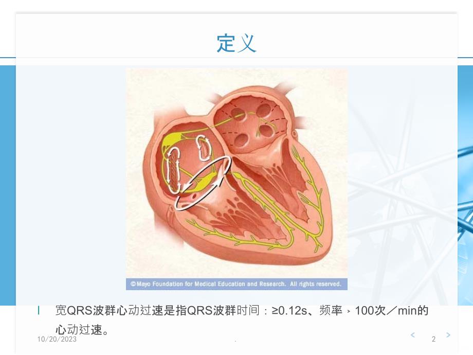 宽QRS波心动过速的PPT课件_第2页