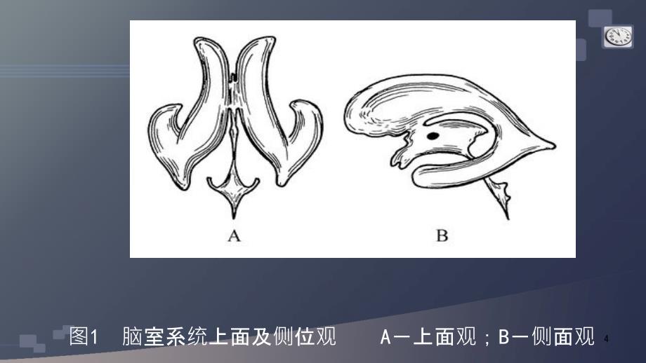 脑室引流术PPT课件_第4页