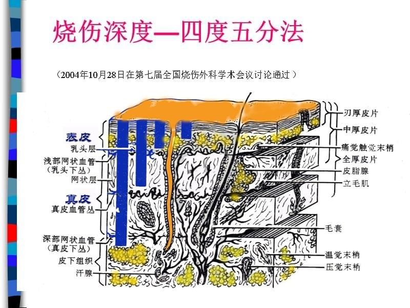 烧伤补液PPT课件_第5页