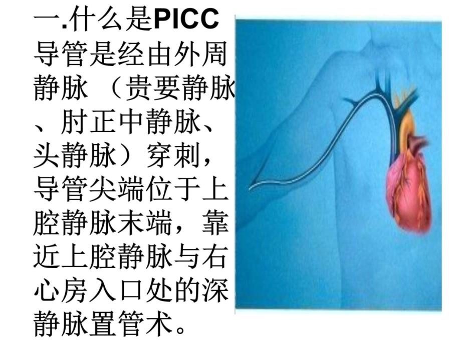 picc的临床应用及维护资料讲解_第4页