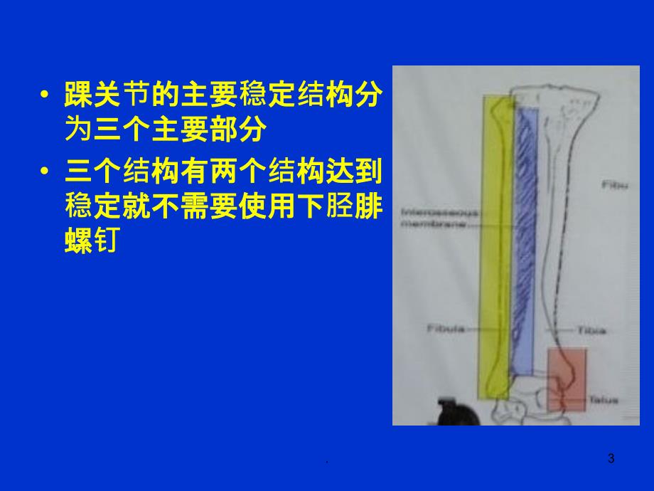 下胫腓有关问题PPT课件_第3页