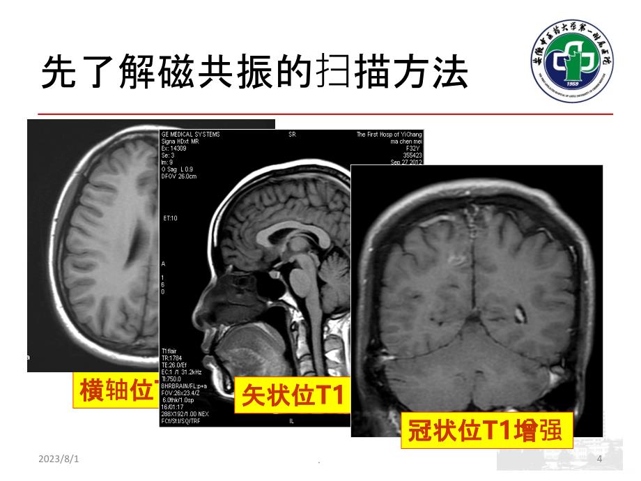 颅脑MRI读片入门PPT课件_第4页