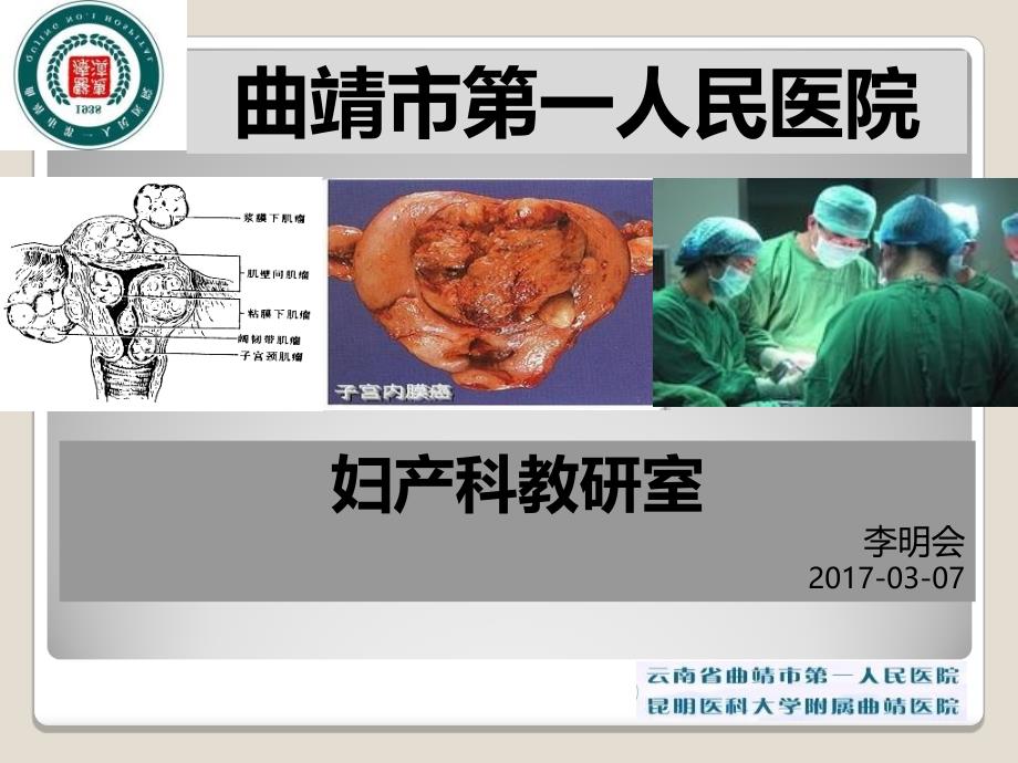 2017子宫肌瘤教学查房教材课程_第1页