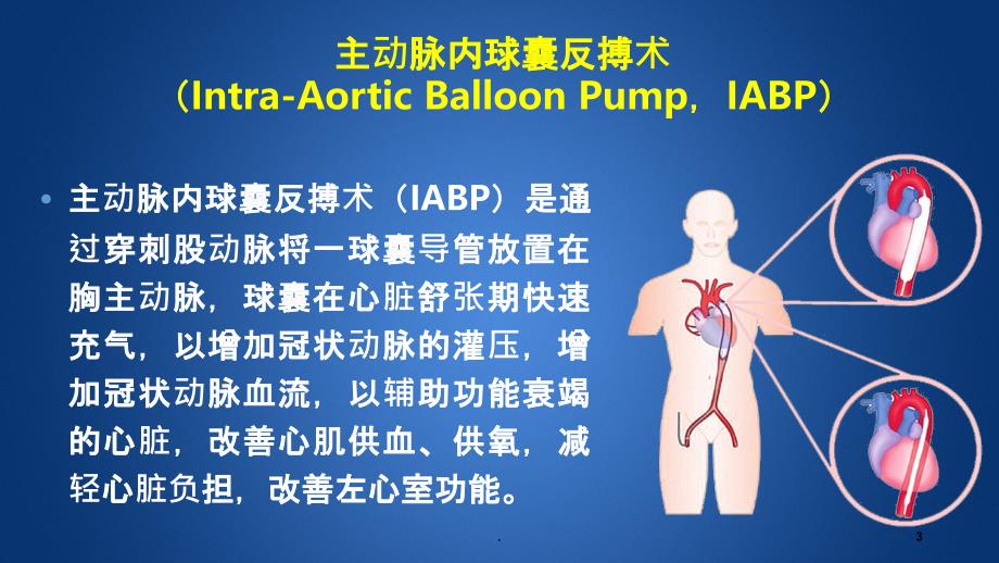 主动脉球囊反搏的护理PPT课件_第3页