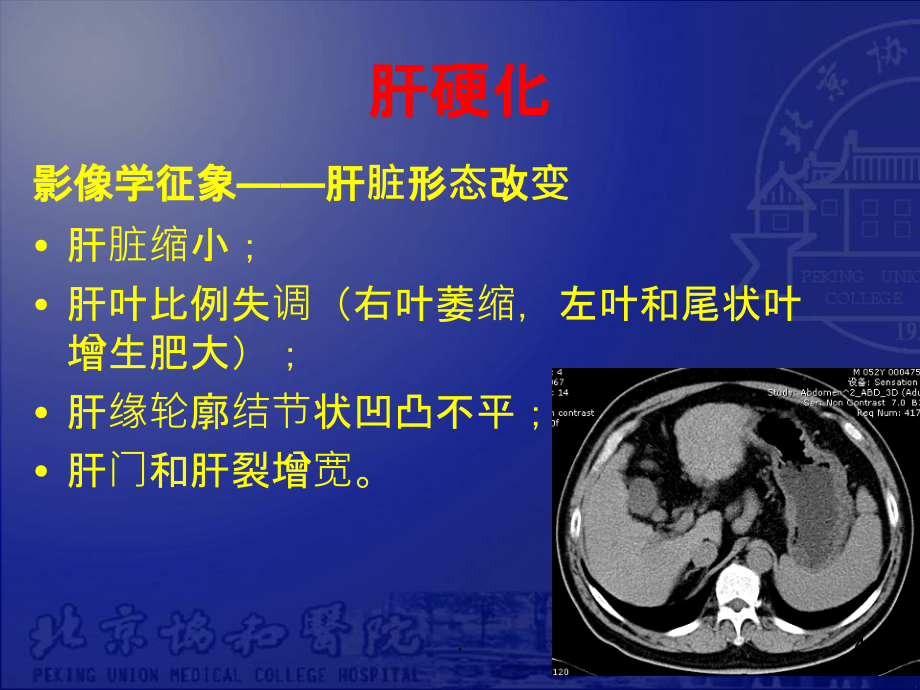 腹部实质脏器疾病影像学表现PPT课件_第4页