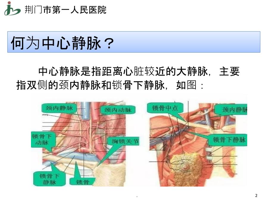 中心静脉穿刺教学PPT课件_第2页