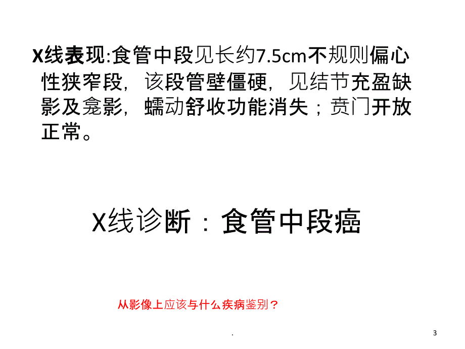 食管癌——放射科罗石PPT课件_第3页