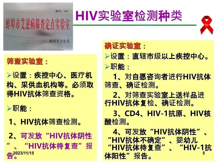 艾滋病感染实验室检测及结果解释PPT课件_第5页