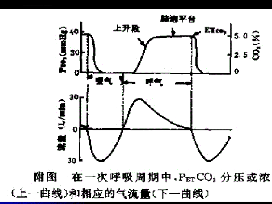 呼末二氧化碳分压（PETCO2）监测在临床麻醉中的应用及意课件_第3页