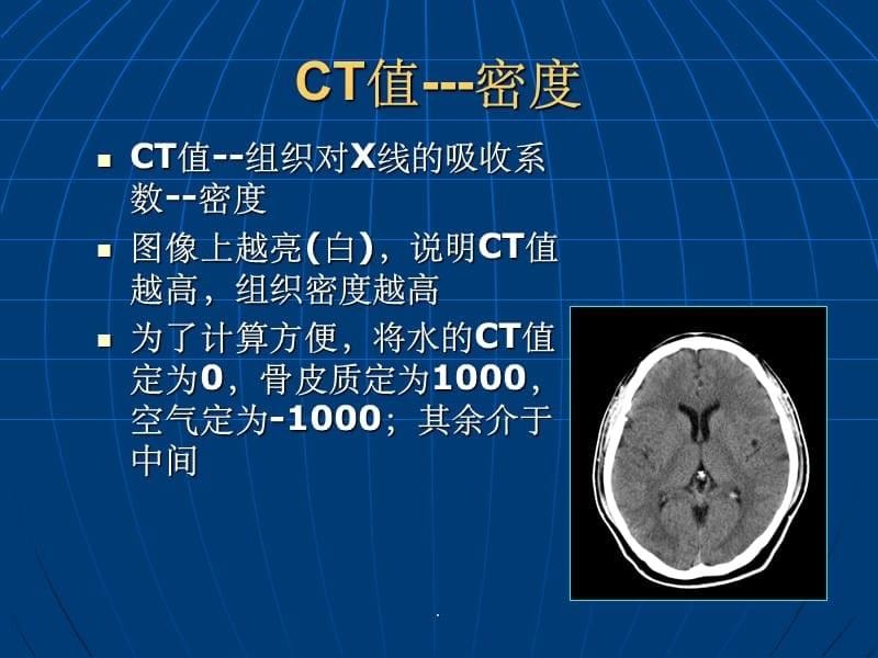 颅脑CT基本影像诊断ppt课件_第5页