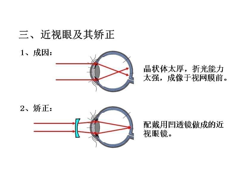 (课堂教学课件）八年级物理上册3 四、眼睛和眼镜课件_第5页