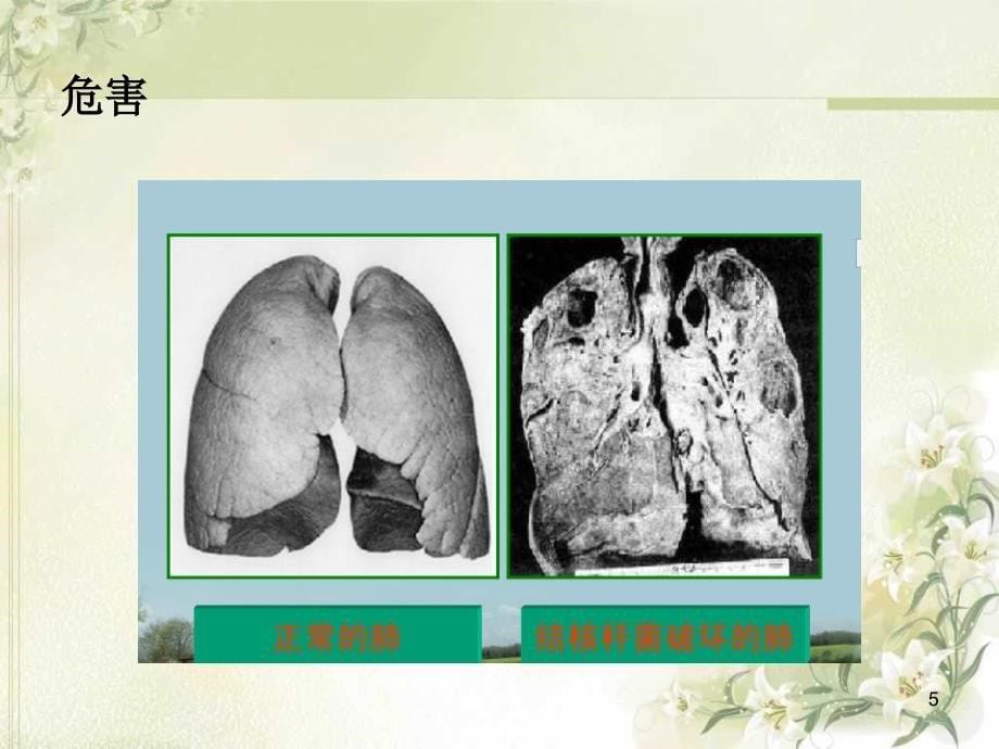 结核分枝杆菌最新检测技术-文档资料_第5页