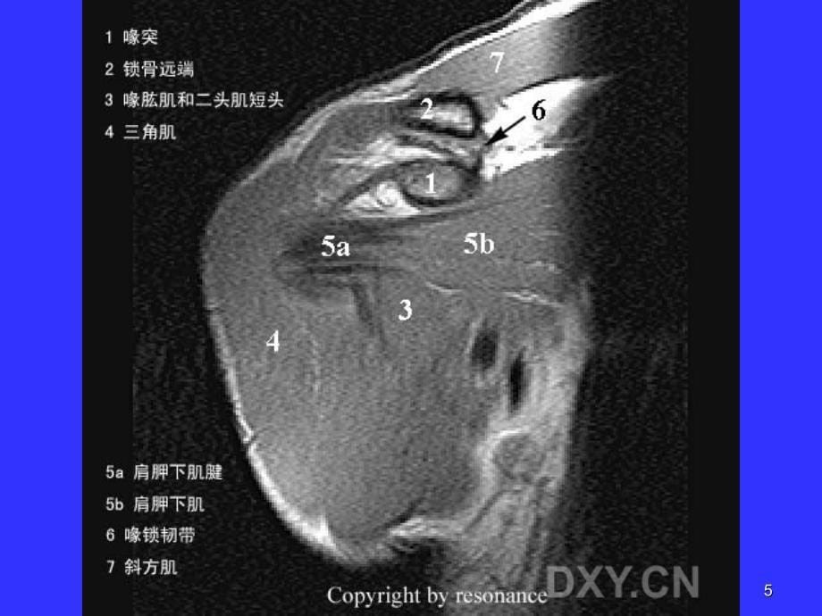 正常肩关节MR表现-文档资料_第5页