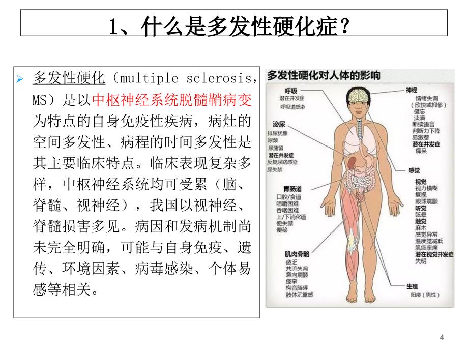 脑脊液寡克隆区带对多发性硬化的诊断意义-文档资料_第4页