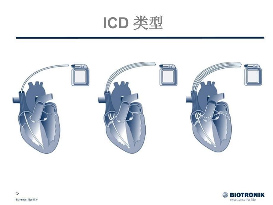 ICD适应证-文档资料_第5页